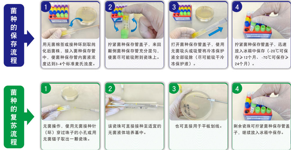 常見(jiàn)菌株保藏法的優(yōu)缺點(diǎn)對(duì)比 常見(jiàn)菌株保藏法的優(yōu)缺點(diǎn)對(duì)比